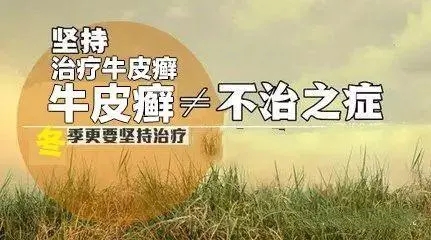 牛皮癣患者为什么要进行巩固治疗呢