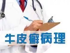 牛皮癣的典型临床特征是什么