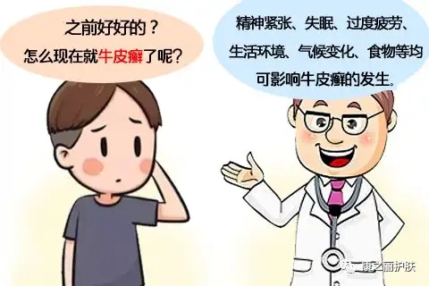 牛皮癣的病因主要有那几点